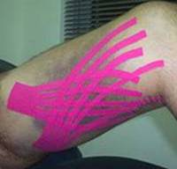 Kinesio Taping